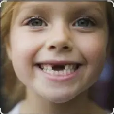 unknown — Мишка Билерман