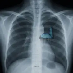 Vsivdoma — Світло