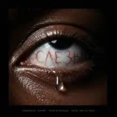 VONAMOUR & Zivert & очки и кольца — Слёзы (feat. Detsl aka Le Truk)